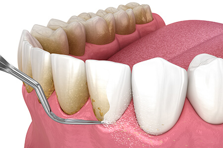 mzg-paradontologie-450x300