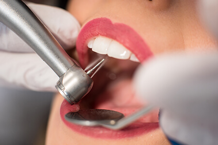 mzg-restauratief-450x300